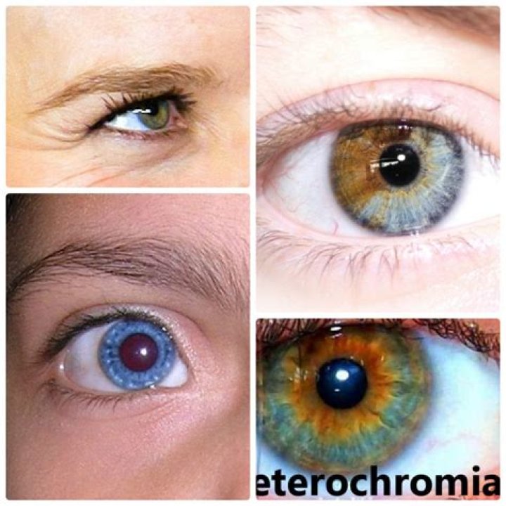 Does Andrew Walker have Heterochromia? Does Andrew Walker have 2 different color eyes?